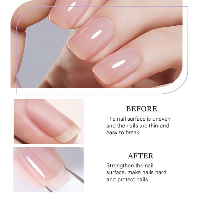 Reinforcement Gel